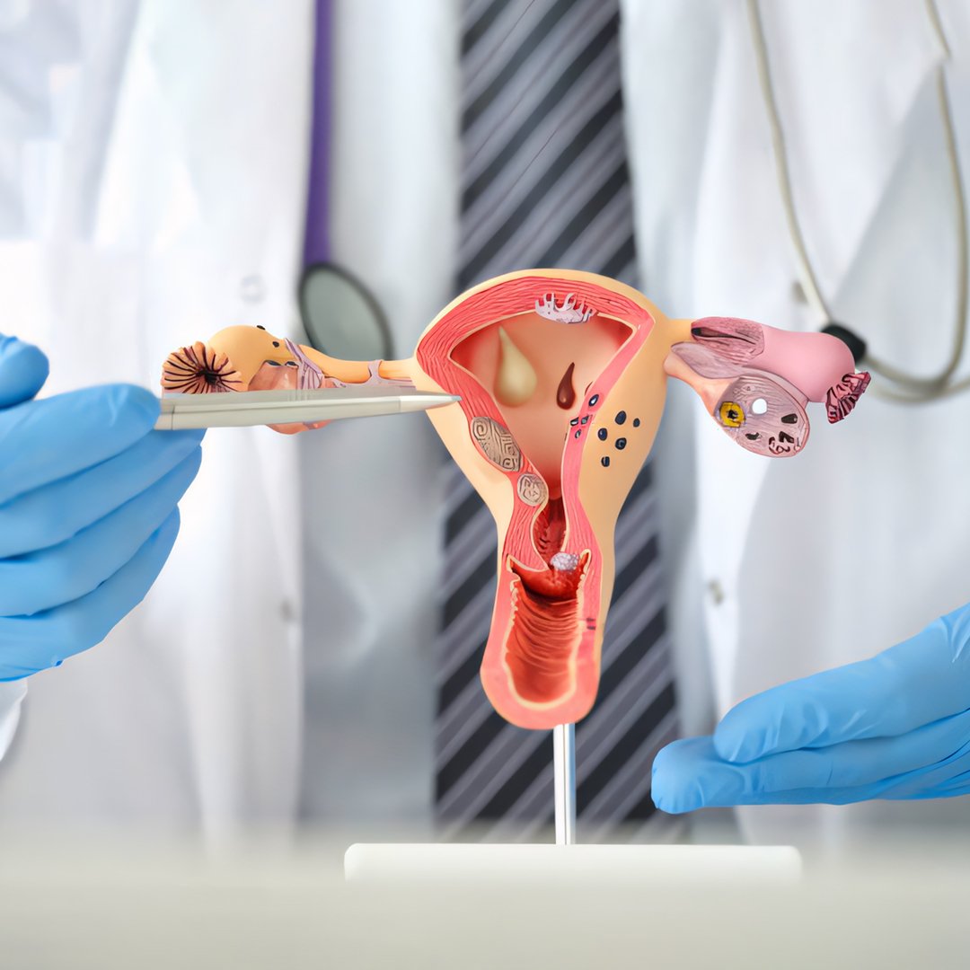 Gynecology Department